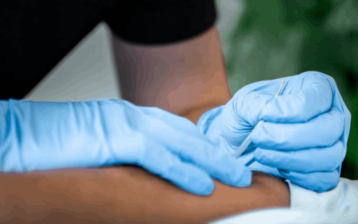 Dry Needling vs Acupuncture: What’s the Difference?